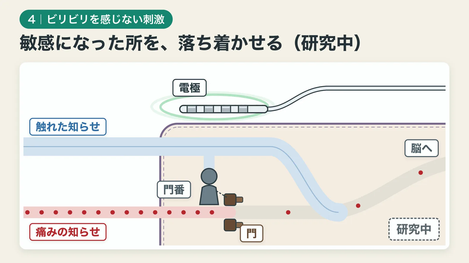 新しい刺激では、ビリビリの知らせは脳へ届かず、敏感になった所を落ち着かせると考えられている（研究中）