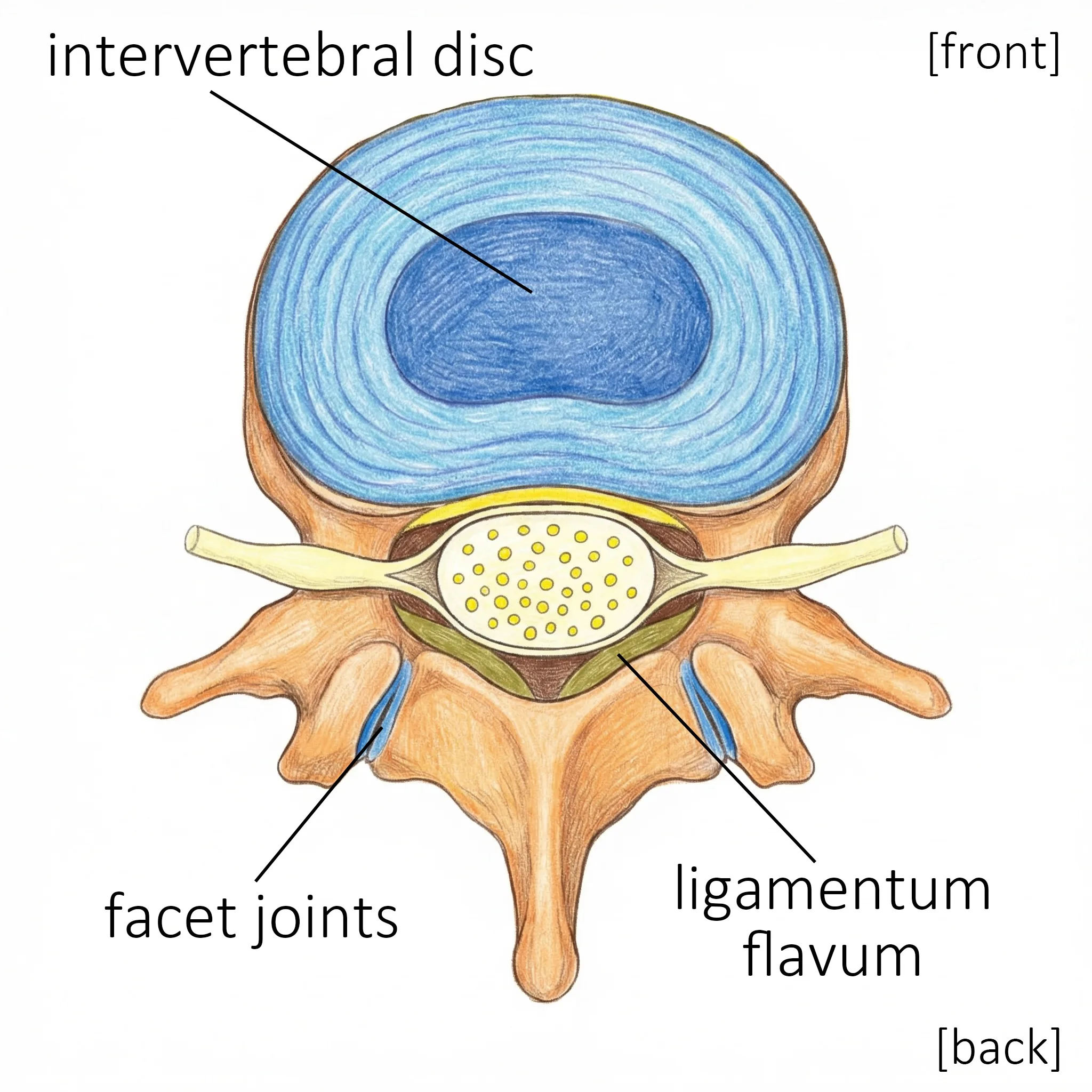 Cross-sectional view of a lumbar vertebra showing the intervertebral disc, spinal canal, facet joints, and ligamentum flavum