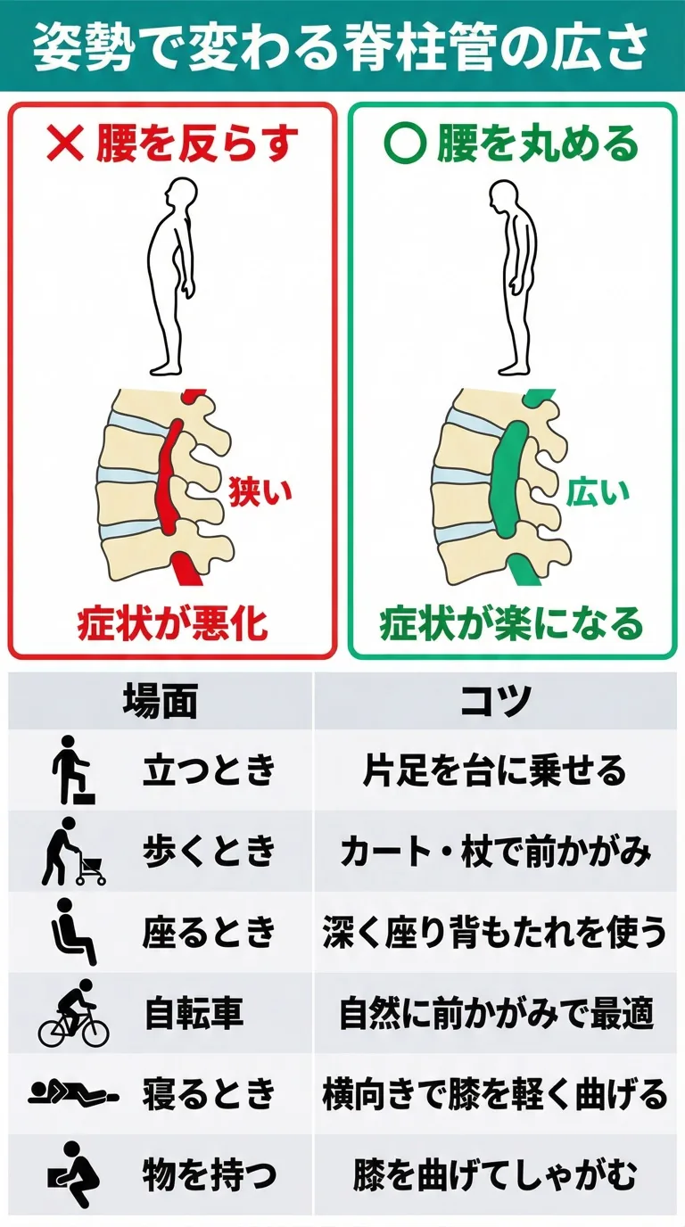 姿勢で変わる脊柱管の広さ：腰を反らすと狭くなり症状が悪化、腰を丸めると広がり症状が楽になる