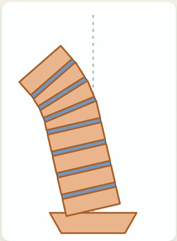 前に大きく傾いた背骨を横から見た図