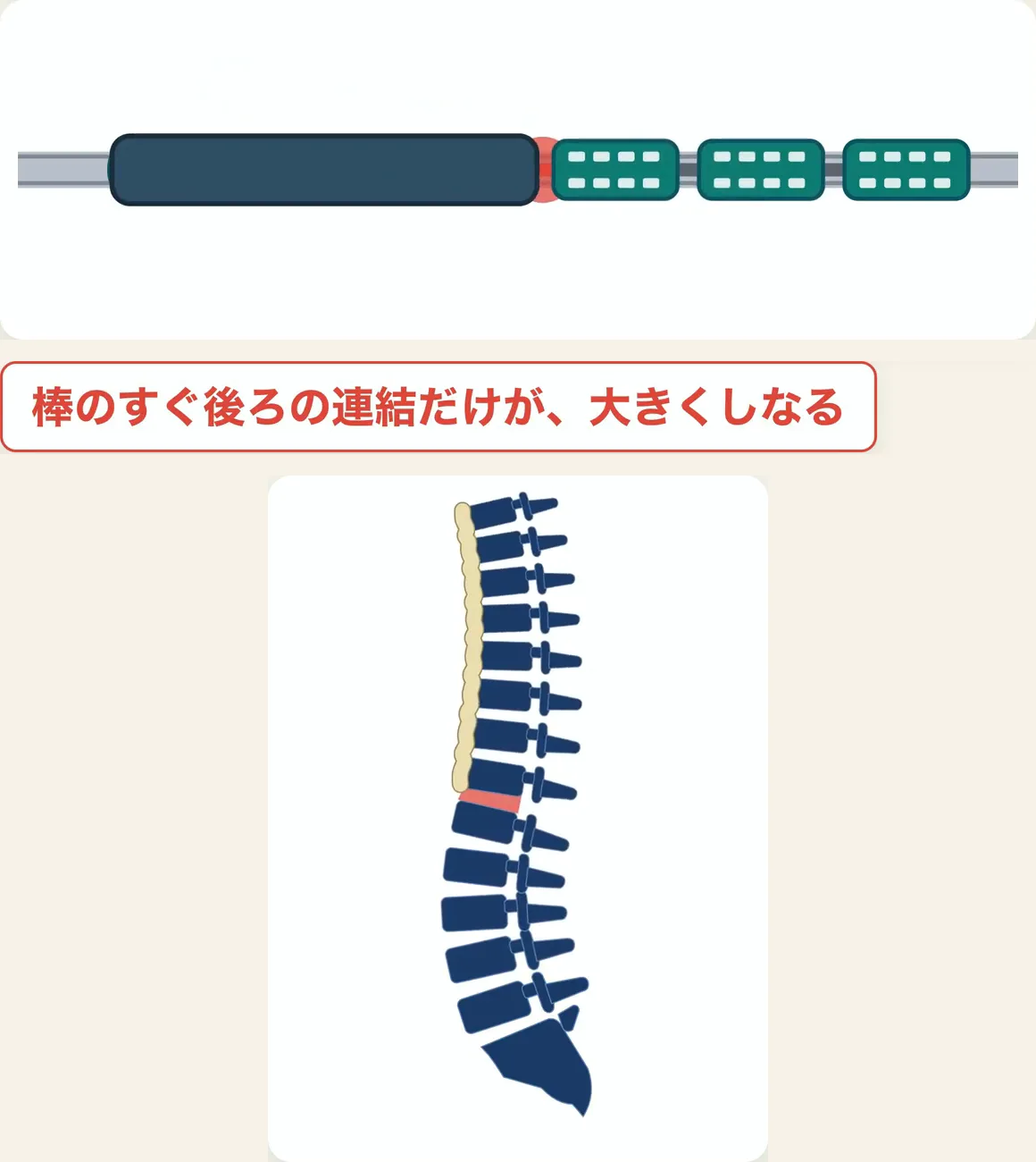 前の車両をつないで一本の棒にした列車と、背骨の模式図。固まった部分（黄色）のすぐ下のつなぎ目（赤）に、負担が集まる