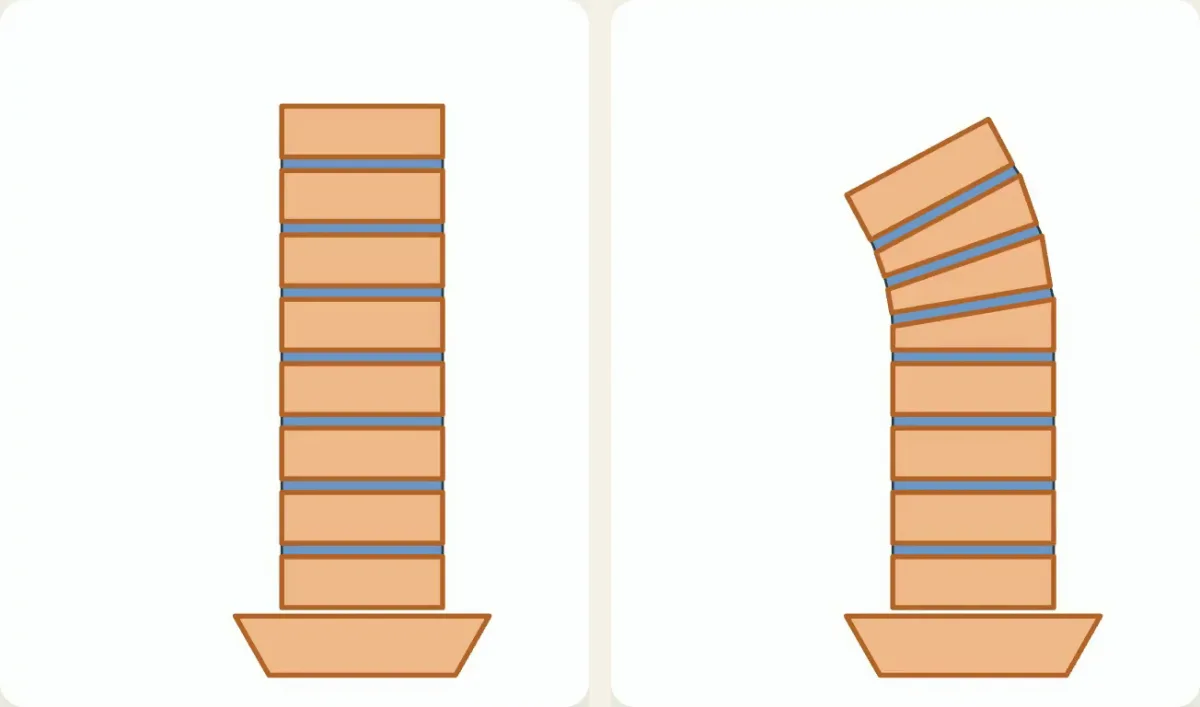 積み重なった背骨の骨の模式図：左はまっすぐ、右は上の骨がつぶれてくさびの形になり、前に曲がっている